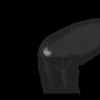 SPORK, NICO - 22.03.1976 - 02.08.2022 - CT obere Extremität - 17:59:07